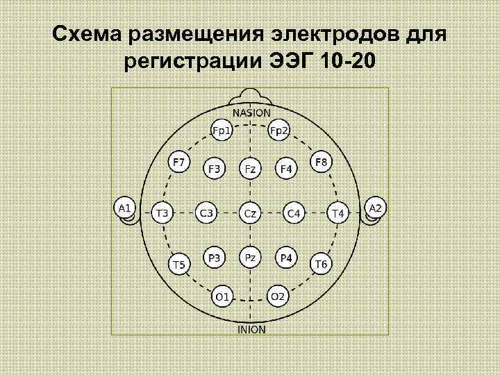 Схема размещения электродов для регистрации ЭЭГ 10 -20 