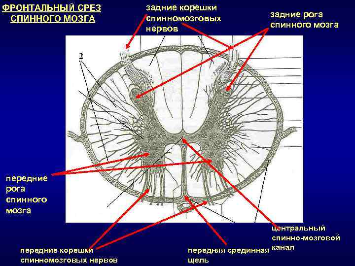 Задний рог мозга. Глиальная перегородка спинного мозга. Дорзальная перегородка спинного мозга. Передняя срединная щель спинного мозга препарат. Задняя срединная перегородка спинного мозга.