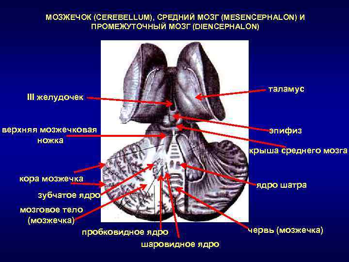 Вырезка мозжечка. Мозжечок анатомия. Мозговое тело мозжечка.