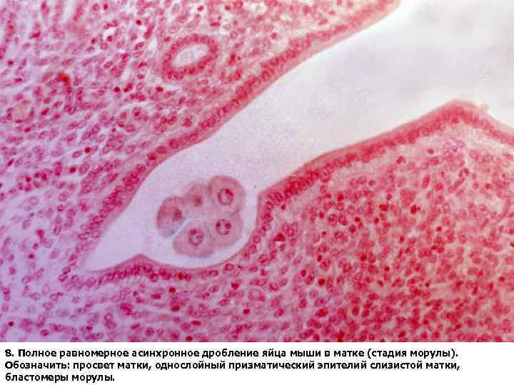 8. Полное равномерное асинхронное дробление яйца мыши в матке (стадия морулы). Обозначить: просвет матки,