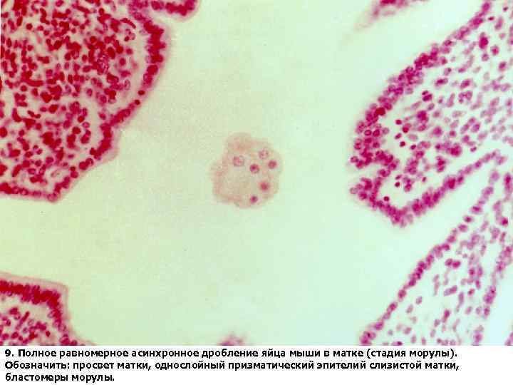 9. Полное равномерное асинхронное дробление яйца мыши в матке (стадия морулы). Обозначить: просвет матки,