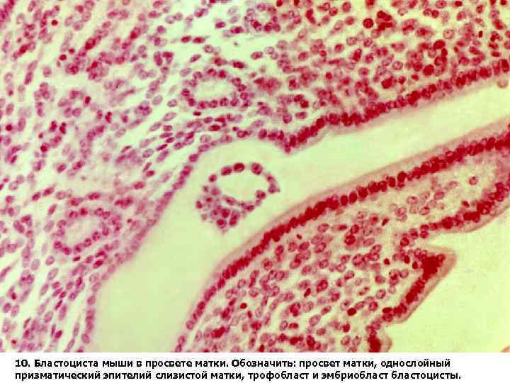 10. Бластоциста мыши в просвете матки. Обозначить: просвет матки, однослойный призматический эпителий слизистой матки,