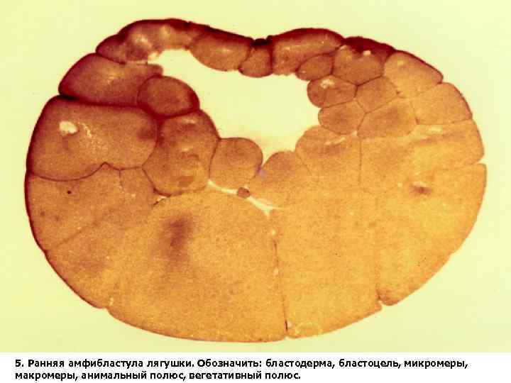 Бластула лягушки рисунок с подписями