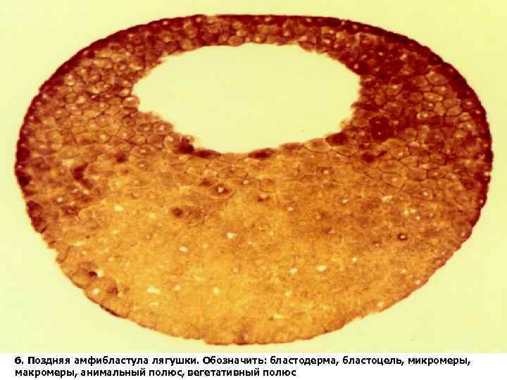 Бластула лягушки. Бластула лягушки амфибластула. Бластула лягушки препарат гистология. Поздняя амфибластула лягушк. Бластула амфибии препарат гистология.
