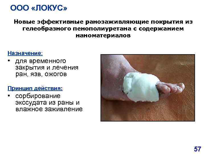 ООО «ЛОКУС» Новые эффективные ранозаживляющие покрытия из гелеобразного пенополиуретана с содержанием наноматериалов Назначение: •