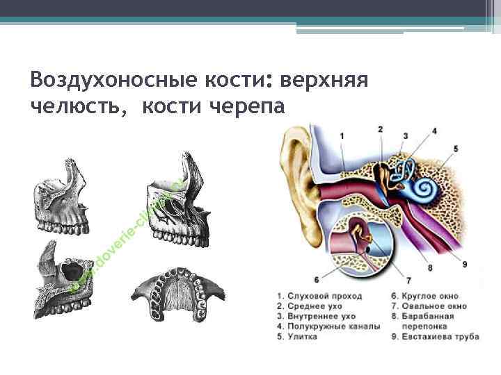 Воздухоносные кости: верхняя челюсть, кости черепа 