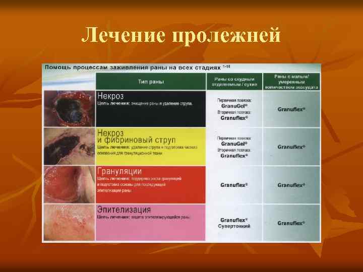 Лечение пролежней 