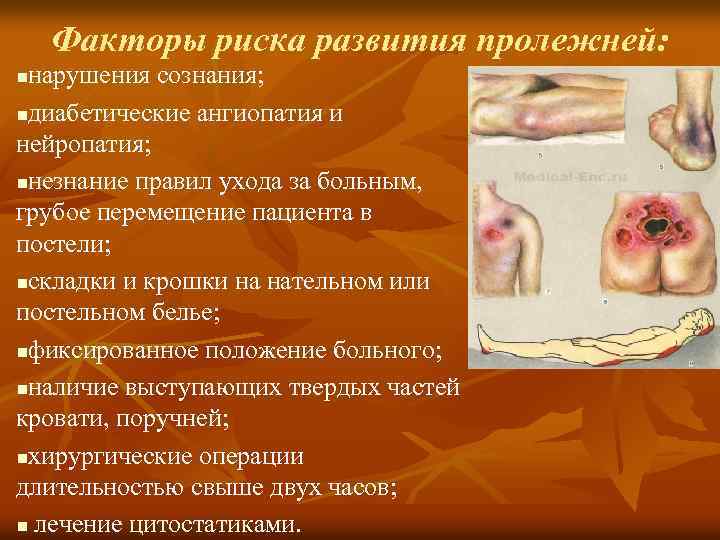 Факторы риска развития пролежней: нарушения сознания; nдиабетические ангиопатия и нейропатия; nнезнание правил ухода за