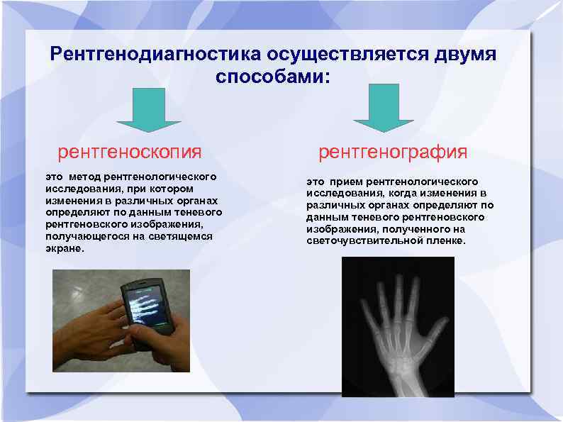 Качество рентгеновского изображения определяется