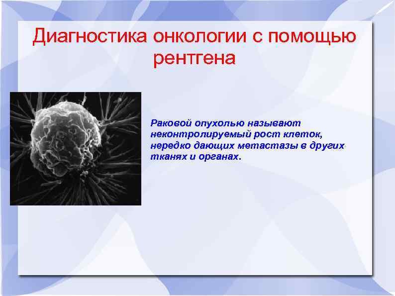Диагностика онкологии с помощью рентгена Раковой опухолью называют неконтролируемый рост клеток, нередко дающих метастазы