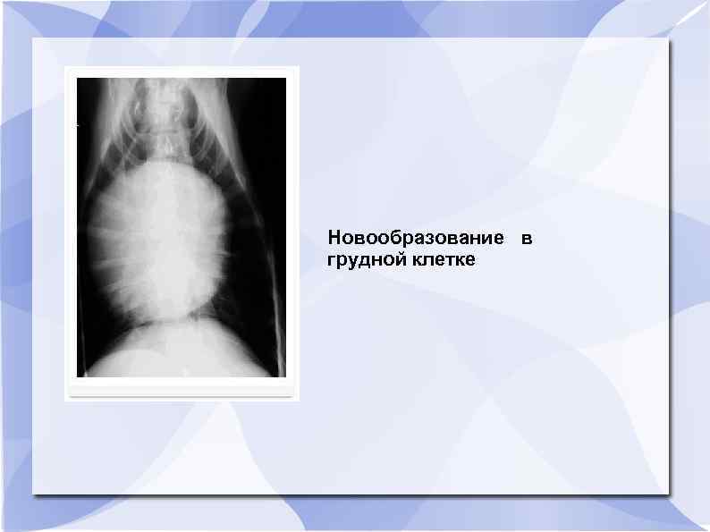 Новообразование в грудной клетке 