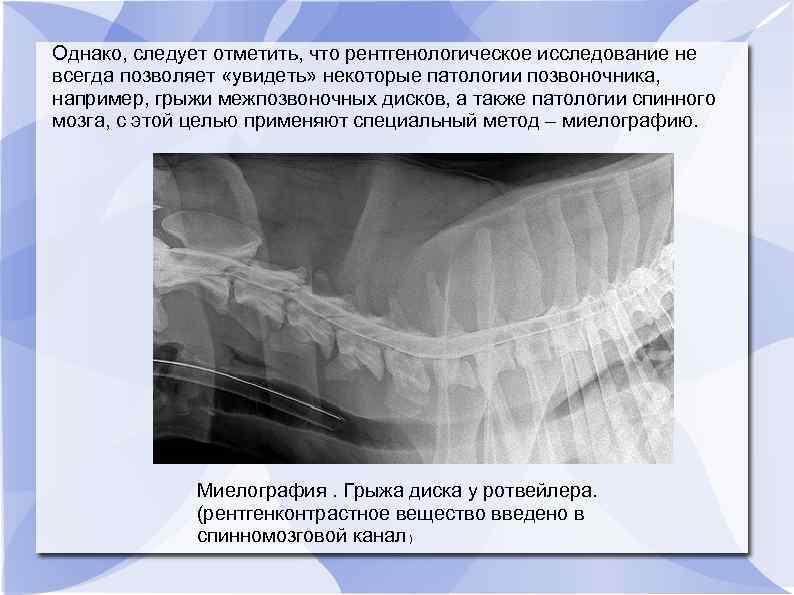 Однако, следует отметить, что рентгенологическое исследование не всегда позволяет «увидеть» некоторые патологии позвоночника, например,