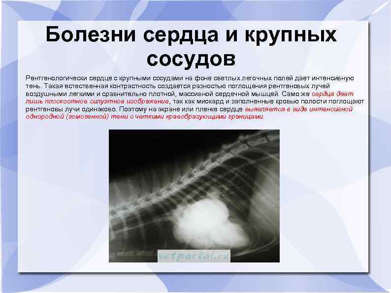 Болезни сердца и крупных сосудов Рентгенологически сердце с крупными сосудами на фоне светлых легочных