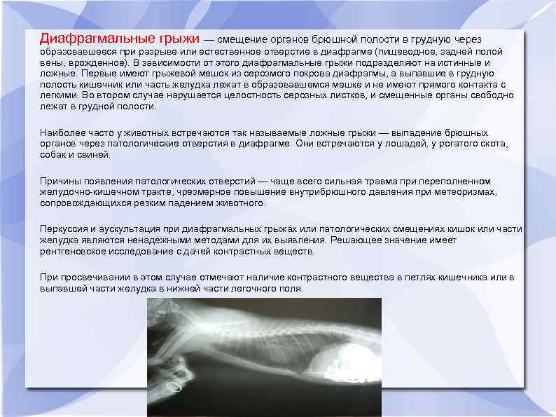 Диафрагмальные грыжи — смещение органов брюшной полости в грудную через образовавшееся при разрыве или