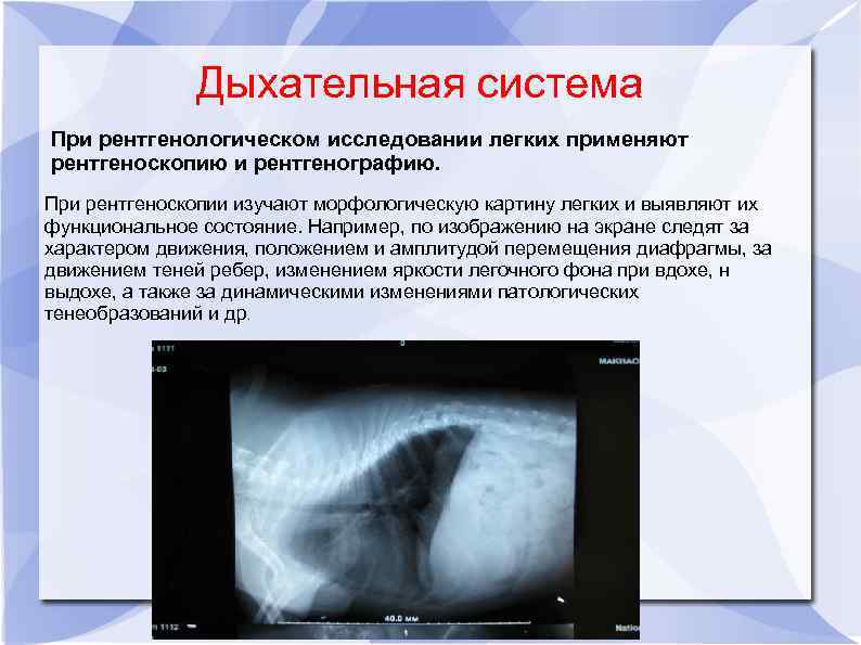 Дыхательная система При рентгенологическом исследовании легких применяют рентгеноскопию и рентгенографию. При рентгеноскопии изучают морфологическую