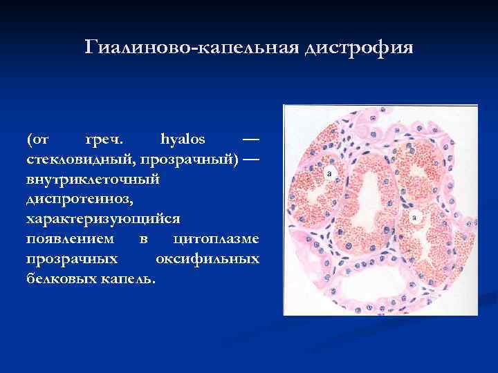 Дисгидроз помфоликс фото