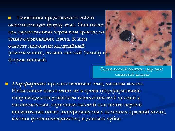 Гематины представляют собой окислительную форму гема. Они имеют вид анизотропных зерен или кристаллов темно-коричневого