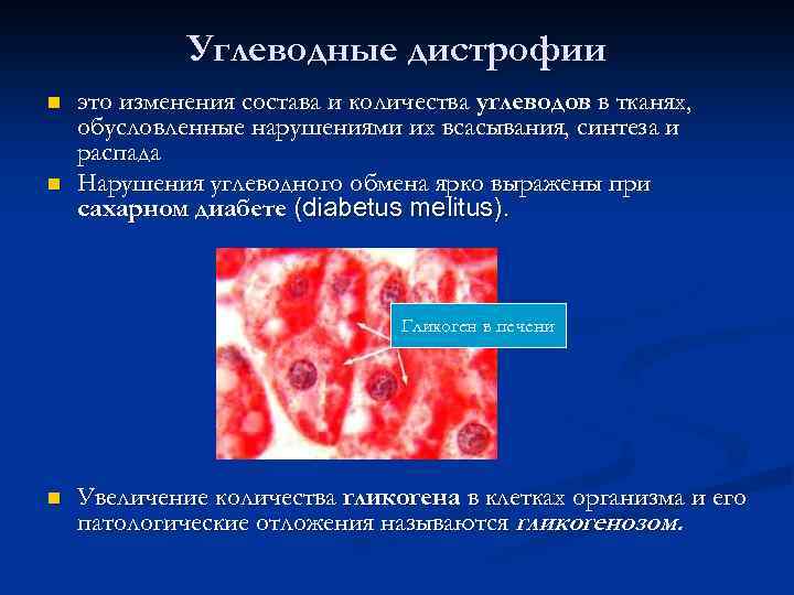 Углеводные дистрофии n n это изменения состава и количества углеводов в тканях, обусловленные нарушениями