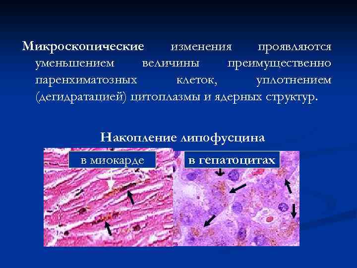 Микроскопические изменения проявляются уменьшением величины преимущественно паренхиматозных клеток, уплотнением (дегидратацией) цитоплазмы и ядерных структур.