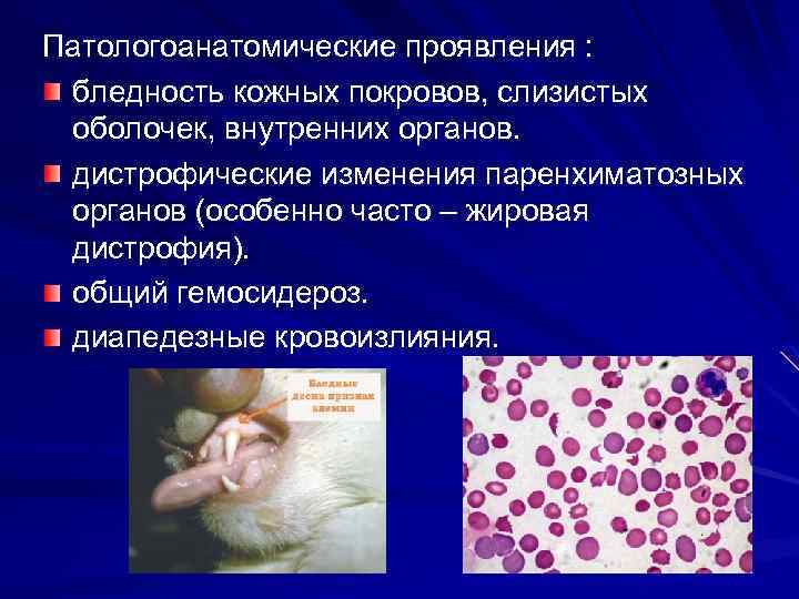 Патологоанатомические проявления : бледность кожных покровов, слизистых оболочек, внутренних органов. дистрофические изменения паренхиматозных органов
