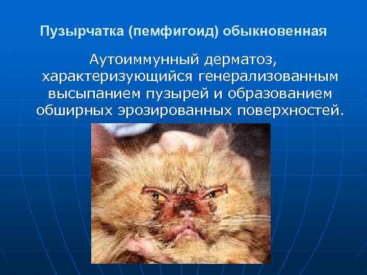Пузырчатка (пемфигоид) обыкновенная Аутоиммунный дерматоз, характеризующийся генерализованным высыпанием пузырей и образованием обширных эрозированных поверхностей.