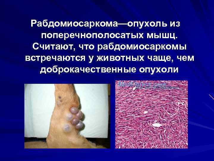 Рабдомиосаркома—опухоль из поперечнополосатых мышц. Считают, что рабдомиосаркомы встречаются у животных чаще, чем доброкачественные опухоли