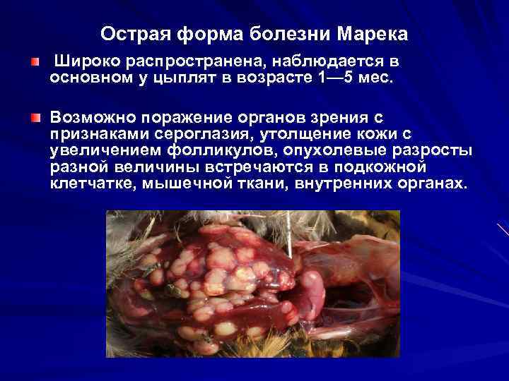 Острая форма болезни Марека Широко распространена, наблюдается в основном у цыплят в возрасте 1—