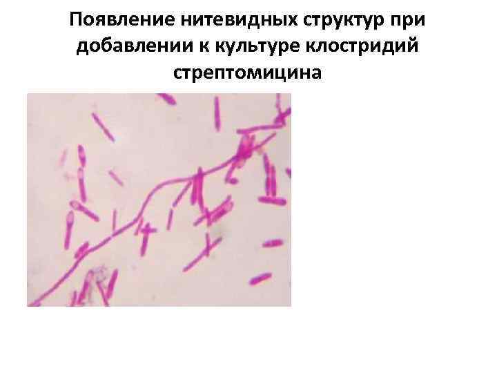 Появление нитевидных структур при добавлении к культуре клостридий стрептомицина 
