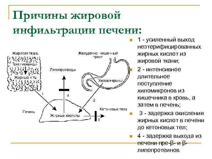 Причины жировой инфильтрации печени: n n 1 - усиленный выход неэтерифицированных жирных кислот из