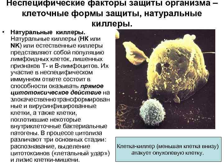 Неспецифические факторы защиты организма – клеточные формы защиты, натуральные киллеры. • Натуральные киллеры (НК
