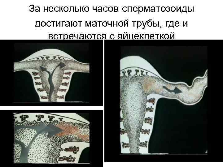 За несколько часов сперматозоиды достигают маточной трубы, где и встречаются с яйцеклеткой 