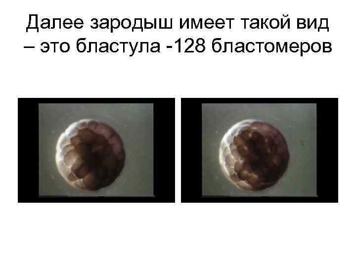 Далее зародыш имеет такой вид – это бластула -128 бластомеров 