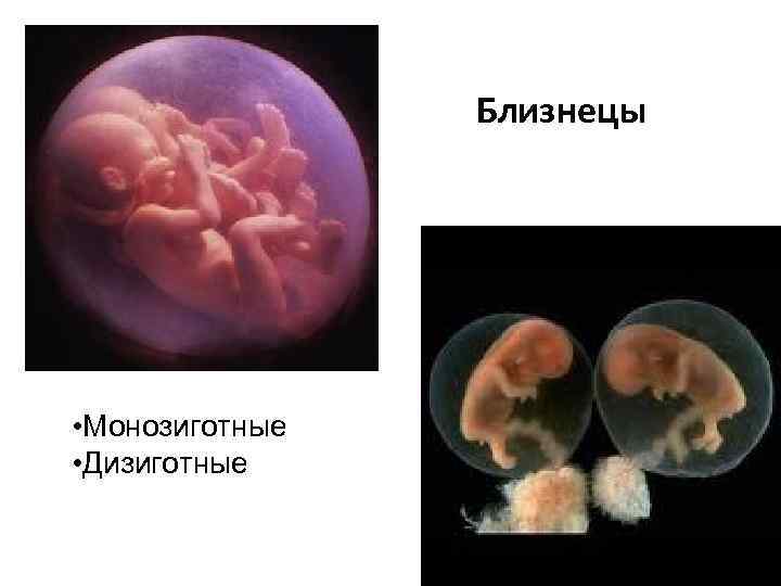 Близнецы • Монозиготные • Дизиготные 