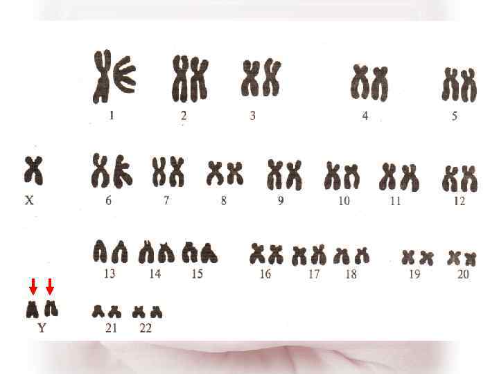 Изменение числа отдельных хромосом
