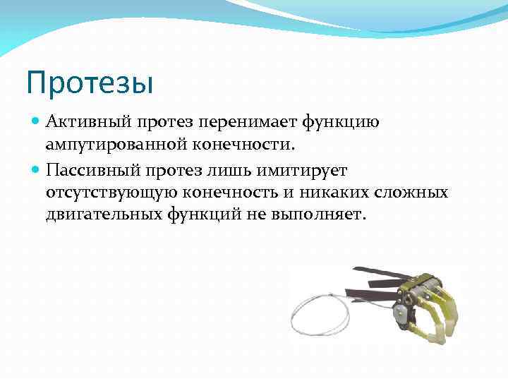 Протезы Активный протез перенимает функцию ампутированной конечности. Пассивный протез лишь имитирует отсутствующую конечность и
