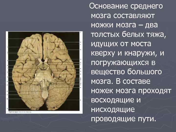 Ноги мозг голова. Препарат среднего мозга. Средние ножки мозга. Ножки среднего мозга.