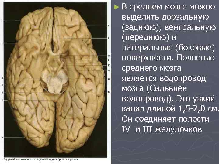 ►В среднем мозге можно выделить дорзальную (заднюю), вентральную (переднюю) и латеральные (боковые) поверхности. Полостью