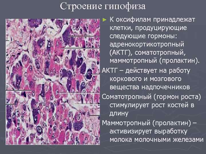 Картина диффузно неоднородной структуры гипофиза