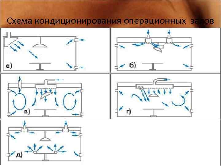 Схема кондиционирования операционных залов 