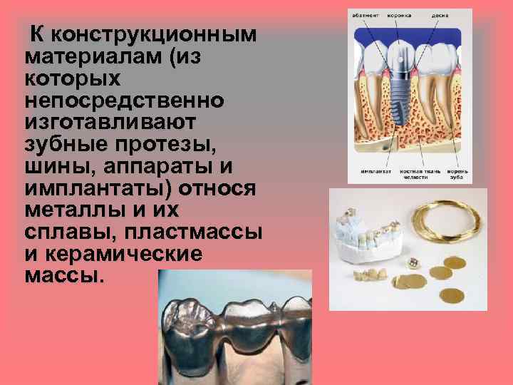 К конструкционным материалам (из которых непосредственно изготавливают зубные протезы, шины, аппараты и имплантаты) относя
