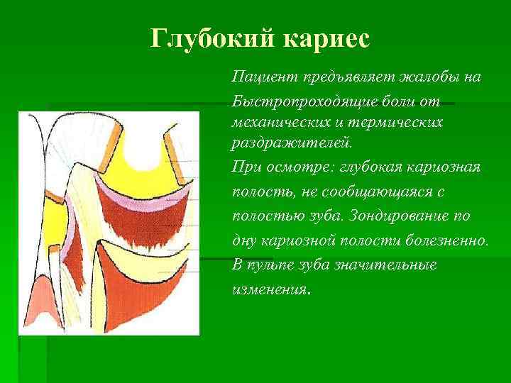 Глубокий кариес Пациент предъявляет жалобы на Быстропроходящие боли от механических и термических раздражителей. При