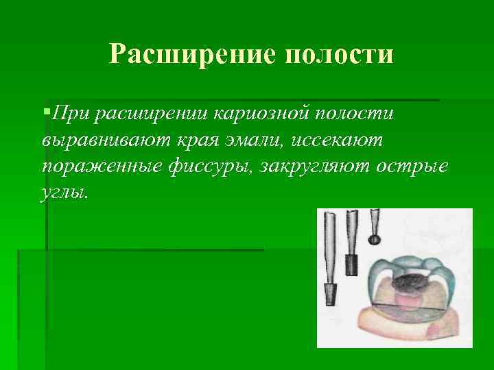 Расширение полости §При расширении кариозной полости выравнивают края эмали, иссекают пораженные фиссуры, закругляют острые