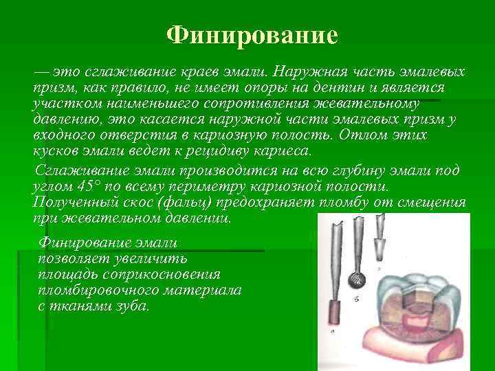 Финирование — это сглаживание краев эмали. Наружная часть эмалевых призм, как правило, не имеет