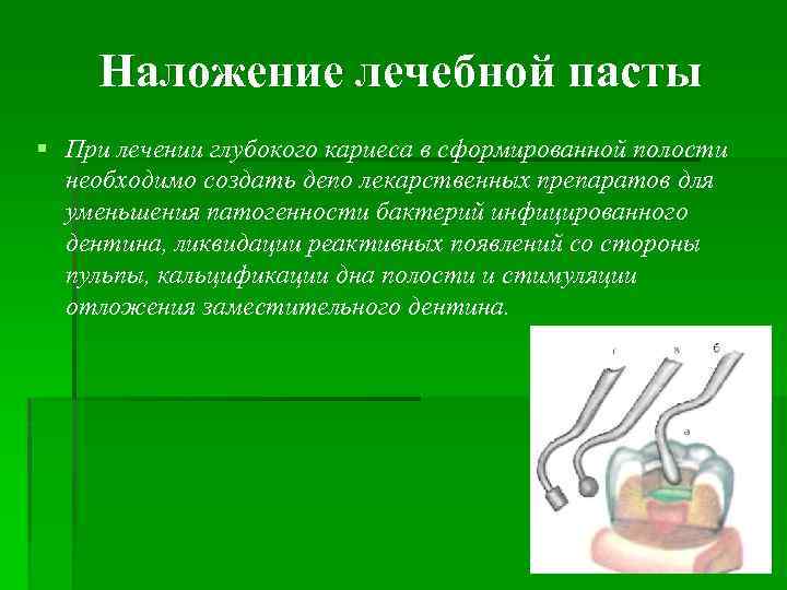 Наложение лечебной пасты § При лечении глубокого кариеса в сформированной полости необходимо создать депо