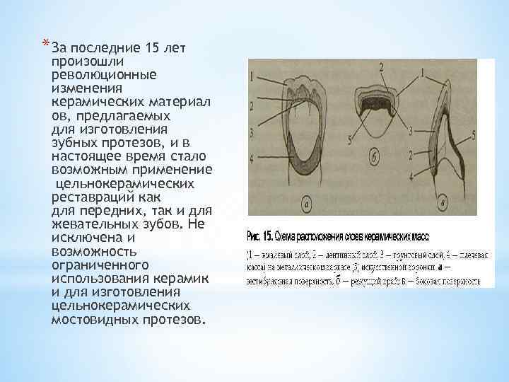 * За последние 15 лет произошли революционные изменения керамических материал ов, предлагаемых для изготовления