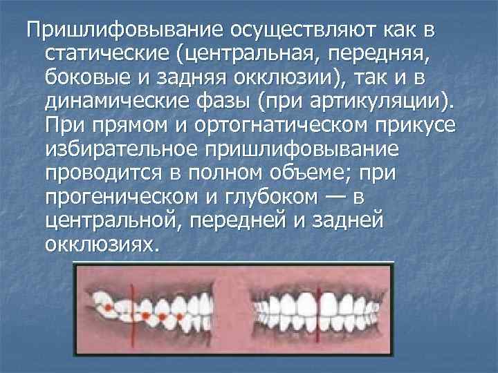 Избирательное пришлифовывание зубов презентация