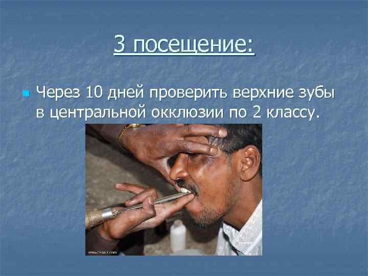 3 посещение: n Через 10 дней проверить верхние зубы в центральной окклюзии по 2