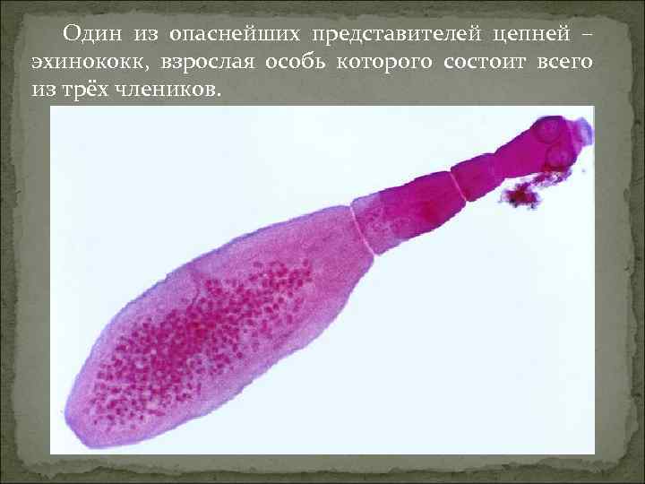 Один из опаснейших представителей цепней – эхинококк, взрослая особь которого состоит всего из трёх