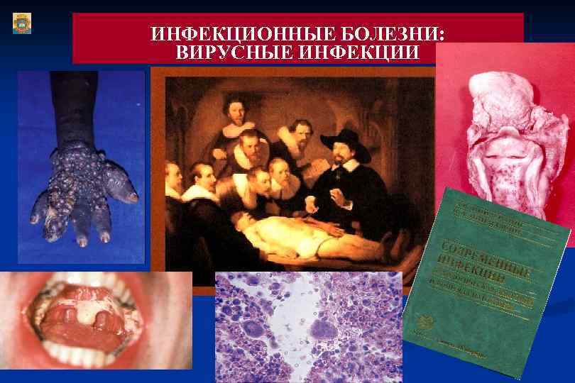 ИНФЕКЦИОННЫЕ БОЛЕЗНИ: ВИРУСНЫЕ ИНФЕКЦИИ 
