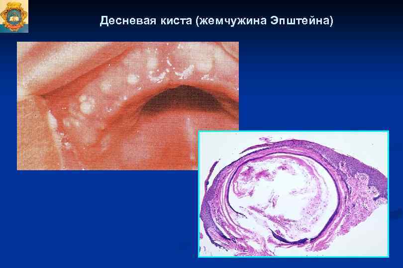 Презентация одонтогенные опухоли